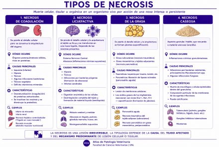 Necrosis
